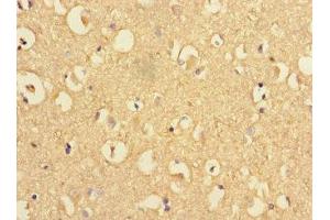 Immunohistochemistry of paraffin-embedded human brain tissue using ABIN7164264 at dilution of 1:100 (Presenilin 1 antibody  (AA 4-218))