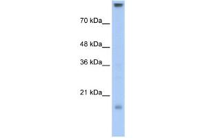 WB Suggested Anti-CLDN11 Antibody Titration:  0. (Claudin 11 antibody  (C-Term))
