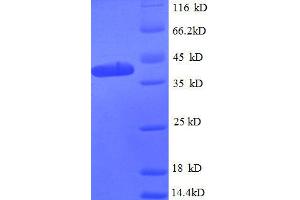 SDS-PAGE (SDS) image for 50S Ribosomal Protein L9 (AA 1-144), (partial) protein (GST tag) (ABIN1046431)