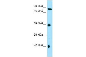 Western Blotting (WB) image for anti-Tetratricopeptide Repeat Domain 4 (TTC4) (C-Term) antibody (ABIN2790316) (TTC4 antibody  (C-Term))