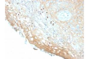 IHC staining of FFPE human cervix with recombinant HPV16 L1 antibody (clone HPV16/2058R). (Human Papilloma Virus 16 Capsid Protein (HPV-16 L1) antibody)
