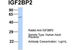 Host:  Rabbit  Target Name:  IGF2BP2  Sample Type:  Human Adult Placenta  Antibody Dilution:  1. (IGF2BP2 antibody  (Middle Region))