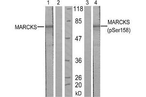 Western blot analysis of extract from starved NIH/3T3 cells, using MARCKS (Ab-158) antibody (E021285, Lane 1 and 2) and MARCKS (phospho-Ser158) antibody (E011293, Lane 3 and 4). (MARCKS antibody)