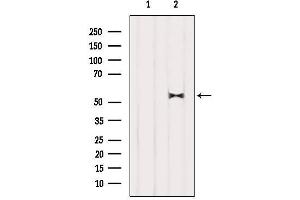Western Blotting (WB) image for anti-Histone Deacetylase 1 (HDAC1) (C-Term) antibody (ABIN6262172)