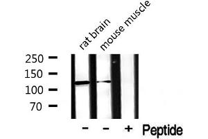 Western blot analysis of extracts from rat and mouse brian, using CDCA2 antibody. (CDCA2 antibody  (Internal Region))