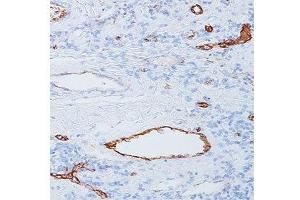 IHC staining of human tonsil with vWF antibody (3E2D10). (VWF antibody  (AA 845-949))