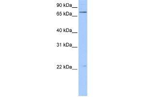 WB Suggested Anti-BFSP1 Antibody Titration:  0. (Filensin antibody  (N-Term))