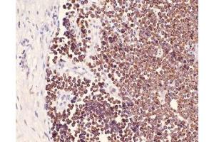 Immunohistochemistry (IHC) image for anti-Keratin 25 (KRT25) (C-Term) antibody (ABIN870622) (Keratin 25 antibody  (C-Term))