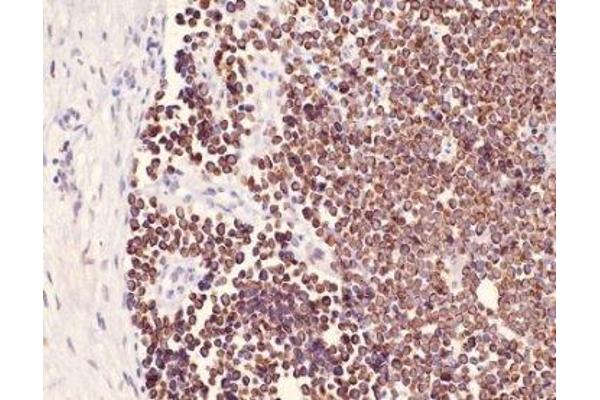 Keratin 25 antibody  (C-Term)