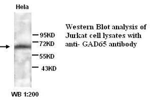 Image no. 1 for anti-Glutamate Decarboxylase 2 (Pancreatic Islets and Brain, 65kDa) (GAD2) antibody (ABIN790972) (GAD65 antibody)