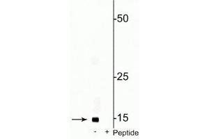 Western blot of rat mitochondrial lysate showing specific immunolabeling of the ~17 kDa COXIV phosphorylated at Ser58 in the first lane (-). (COX IV antibody  (pSer58))