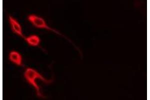 ABIN6277896 staining  Hela cells by IF/ICC. (MYOD1 antibody  (Internal Region))