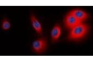 Immunofluorescent analysis of BCAR3 staining in MCF7 cells. (BCAR3 antibody  (C-Term))