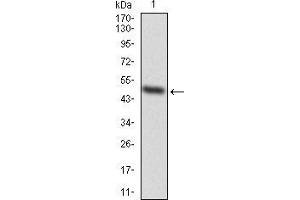 Western blot analysis using EZH2 mAb against human EZH2 (AA: 1-194) recombinant protein. (EZH2 antibody  (AA 1-194))