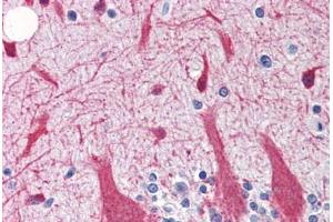 Human Brain, Cerebellum (formalin-fixed, paraffin-embedded) stained with SNCG antibody ABIN364362 at 5 ug/ml followed by biotinylated goat anti-rabbit IgG secondary antibody ABIN481713, alkaline phosphatase-streptavidin and chromogen. (SNCG antibody)