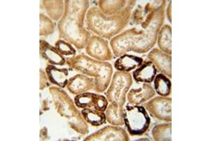 Formalin-fixed and paraffin-embedded human brain tissue reacted with LRRC4 Antibody (C-term) followed which was peroxidase-conjugated to the secondary antibody, followed by DAB staining. (LRRC4 antibody  (C-Term))