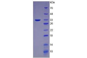 SDS-PAGE analysis of Mouse Keratin 5 Protein. (Cytokeratin 5 Protein)