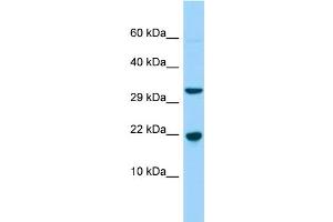 WB Suggested Anti-CABP5 Antibody Titration: 1.