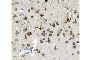 IHC analysis of Thioredoxin 2/TXN2 using anti-Thioredoxin 2/TXN2 antibody (ABIN7602148).