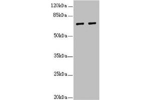 Western blot All lanes: IWS1 antibody at 3. (IWS1 antibody  (AA 570-819))