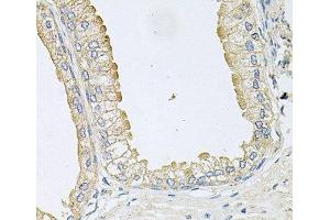Immunohistochemistry of paraffin-embedded Human prostate using ANKH Polyclonal Antibody at dilution of 1:100 (40x lens). (ANKH antibody)