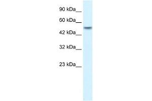 WB Suggested Anti-ANKRD11 Antibody Titration:  1. (ANKRD11 antibody  (N-Term))
