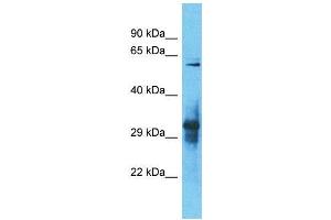 Western Blotting (WB) image for anti-IgLON Family Member 5 (IGLON5) (C-Term) antibody (ABIN2791585) (IGLON5 antibody  (C-Term))
