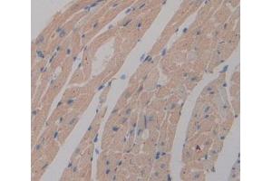 Used in DAB staining on fromalin fixed paraffin- embedded Kidney tissue (PGAM2 antibody  (AA 1-253))