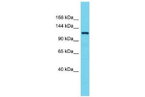 Host:  Rabbit  Target Name:  Hdac7  Sample Type:  Rat Spleen lysates  Antibody Dilution:  1. (HDAC7 antibody  (N-Term))