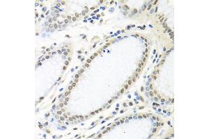 Immunohistochemistry of paraffin-embedded human stomach using ELAVL1 antibody. (ELAVL1 antibody)