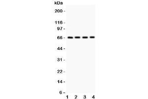 Western blot testing of Optineurin antibody and Lane 1:  HeLa;  2: U87;  3: SMMC;  4: HT1080. (OPTN antibody  (AA 241-577))