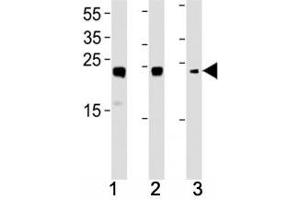 HMGB2 antibody western blot analysis in (1) HL-60, (2) K562, (3) H-4-II-E lysate. (HMGB2 antibody  (AA 92-118))