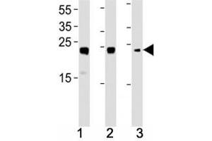 HMGB2 antibody western blot analysis in (1) HL-60, (2) K562, (3) H-4-II-E lysate. (HMGB2 antibody  (AA 92-118))