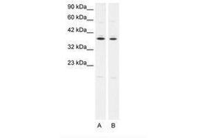 Image no. 1 for anti-Prostaglandin E Receptor 3 (Subtype EP3) (PTGER3) (C-Term) antibody (ABIN202406) (PTGER3 antibody  (C-Term))