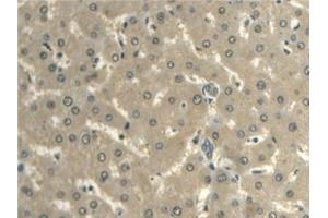 Immunohistochemistry (IHC) image for anti-Aldehyde Dehydrogenase 1 Family, Member A2 (ALDH1A2) (AA 1-422) antibody (ABIN7435901)