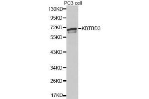 Western blot analysis of extracts of PC3 cell lines, using KBTBD3 antibody. (KBTBD3 antibody  (AA 410-607))