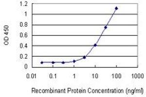 Detection limit for recombinant GST tagged LIMA1 is 0. (LIMA1 antibody  (AA 1-598))