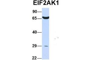 Western Blotting (WB) image for anti-Eukaryotic Translation Initiation Factor 2-alpha Kinase 1 (EIF2AK1) (N-Term) antibody (ABIN2775397)