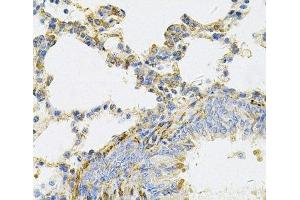 Immunohistochemistry of paraffin-embedded Rat lung using UBE2B Polyclonal Antibody at dilution of 1:100 (40x lens). (UBE2B antibody)