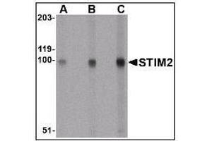 Western blot analysis for AP22869PU-N of STIM2 in A-20 cell lysate with at (A) 0. (Stim2 antibody)