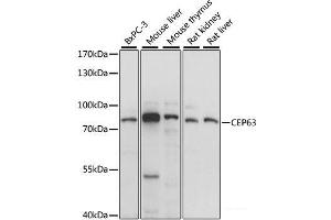 Western blot analysis of extracts of various cell lines using CEP63 Polyclonal Antibody at dilution of 1:1000. (CEP63 antibody)