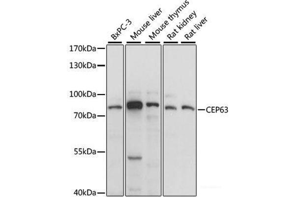 CEP63 anticorps