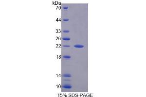 SDS-PAGE analysis of Human PFDN2 Protein. (PFDN2 Protein)