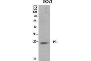 Western Blot (WB) analysis of SKOV3 cells using Prolactin Polyclonal Antibody. (Prolactin antibody  (Internal Region))