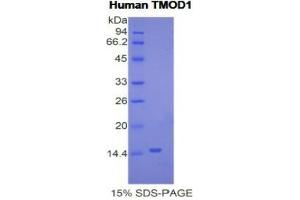 SDS-PAGE analysis of Human Tropomodulin 1 Protein.