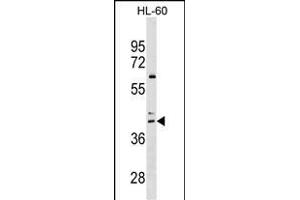 CCR4 Antibody (C-term) (ABIN1536966 and ABIN2849635) western blot analysis in HL-60 cell line lysates (35 μg/lane). (CCR4 antibody  (C-Term))