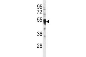 Western blot analysis of IRF8 antibody and HL-60 lysate. (IRF8 antibody  (AA 384-409))