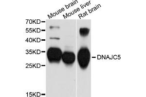 Western blot analysis of extracts of various cell lines, using DNAJC5 antibody (ABIN5997602) at 1/1000 dilution.