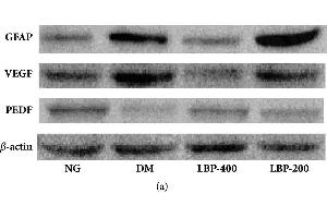 Western Blotting (WB) image for anti-Actin, beta (ACTB) (AA 1-50) antibody (ABIN724340)