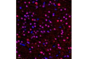 Immunofluorescence of paraffin embedded rat brain using HOXC9 (ABIN7074251) at dilution of 1:650 (400x lens) (HOXC9 antibody)